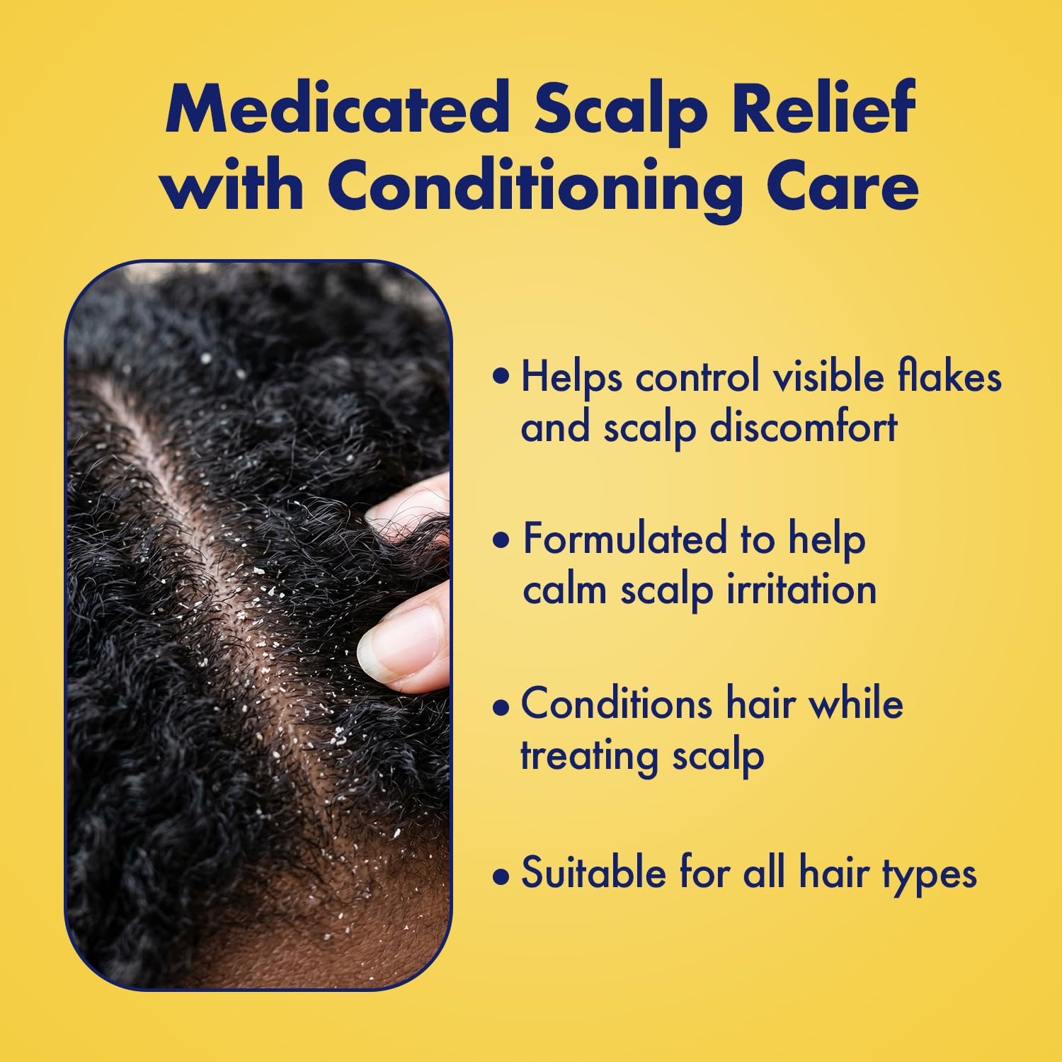 Sulfur8 Medicated Original Formula Anti-Dandruff Hair & Scalp Conditioner
